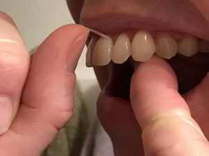 Whiter Teeth with Luster #teeth #beauty #luster #ad