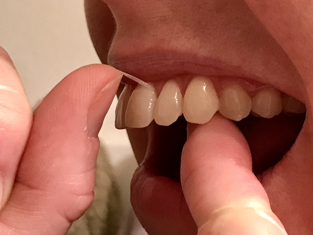 Whiter Teeth with Luster #teeth #beauty #luster #ad