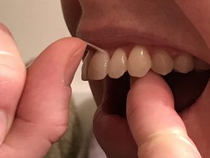 Whiter Teeth with Luster #teeth #beauty #luster #ad