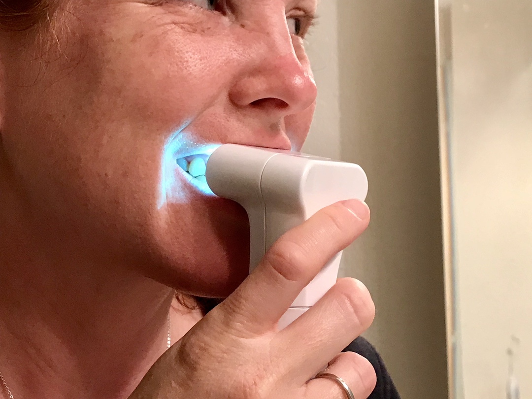 Whiter Teeth with Luster #teeth #beauty #luster #ad