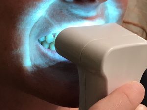 Whiter Teeth with Luster #teeth #beauty #luster #ad