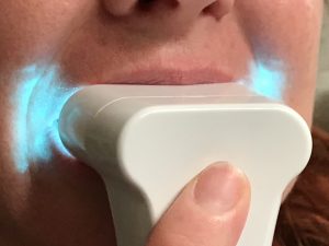 Whiter Teeth with Luster #teeth #beauty #luster #ad