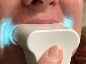 Whiter Teeth with Luster #teeth #beauty #luster #ad