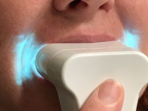 Whiter Teeth with Luster #teeth #beauty #luster #ad