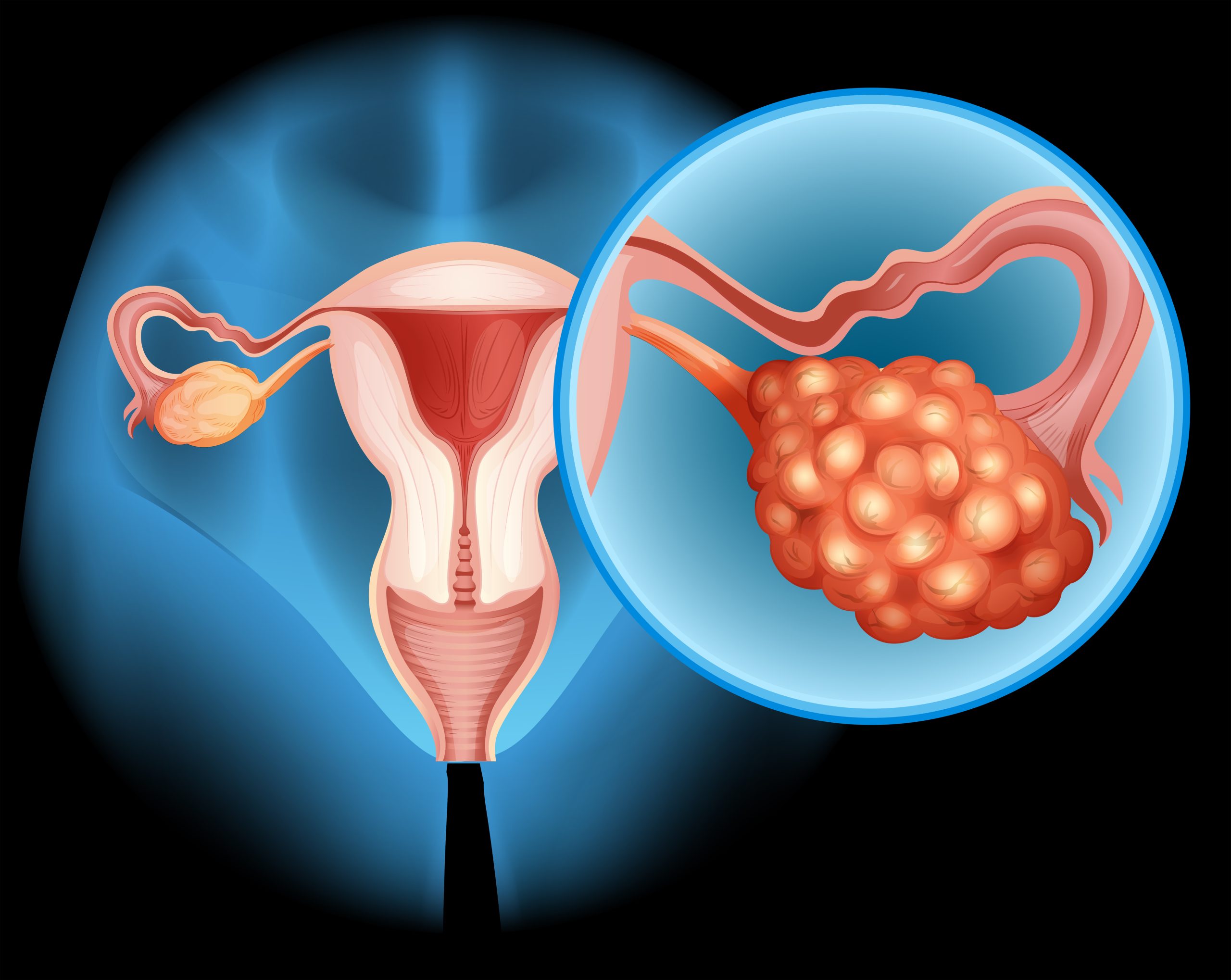 pregnancy pregnant gestational diabetes